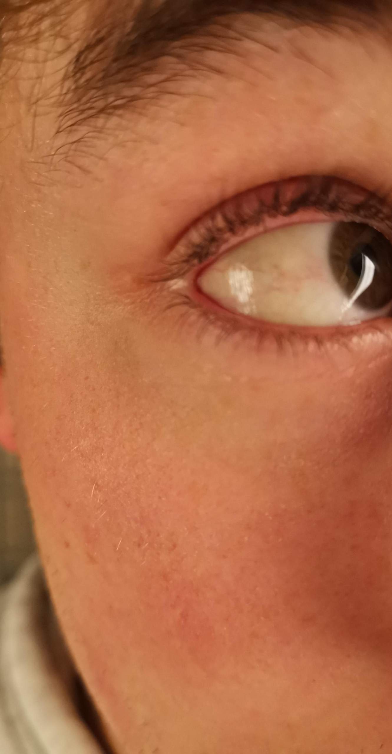 leicht gelblicher rand am auge? (Gesundheit, Medizin, Körper)