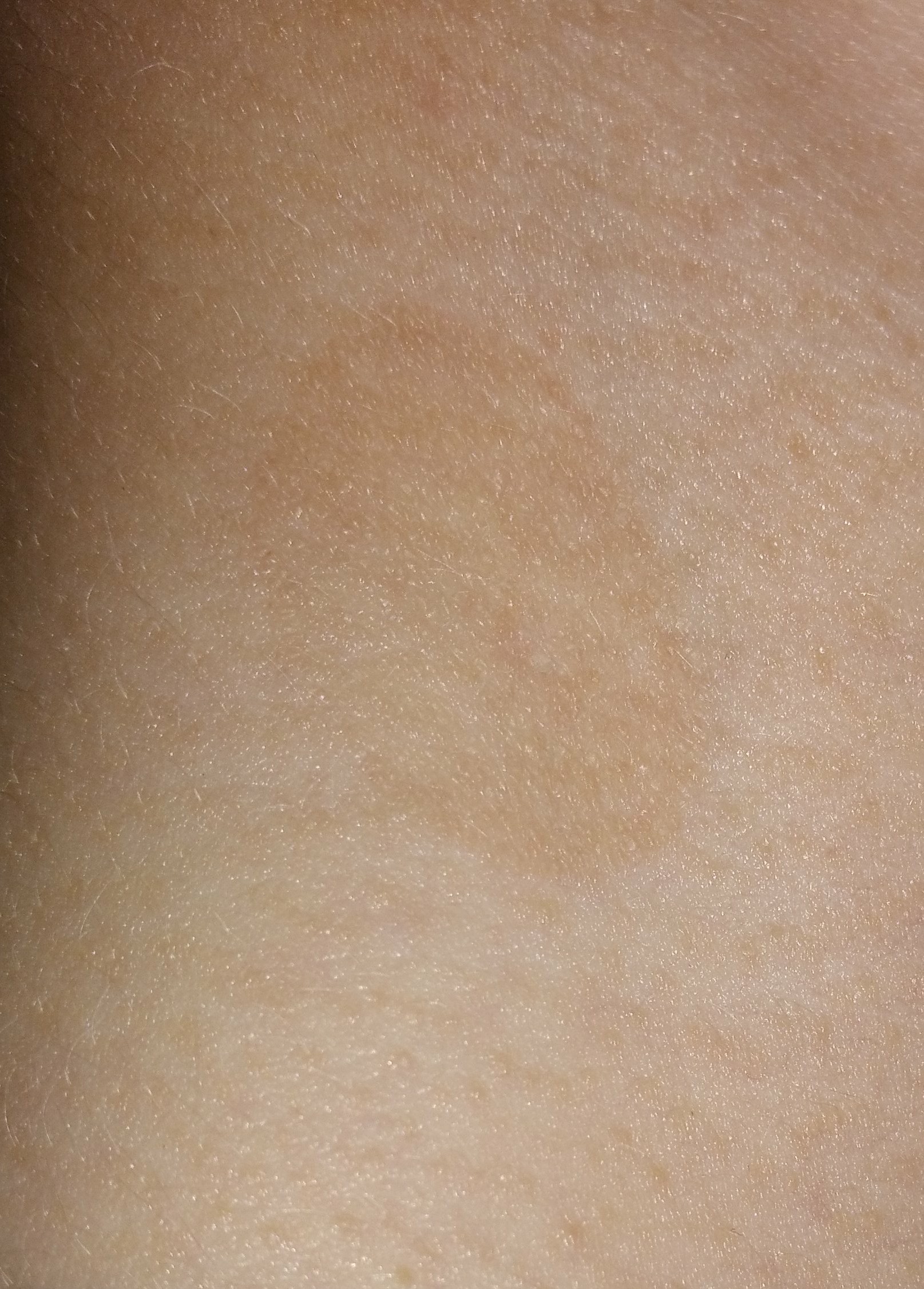 Leichte Braune Flecken auf der Haut? (Gesundheit, Hautarzt) Leichte Braune Flecken auf der Haut? (Gesundheit, Hautarzt)