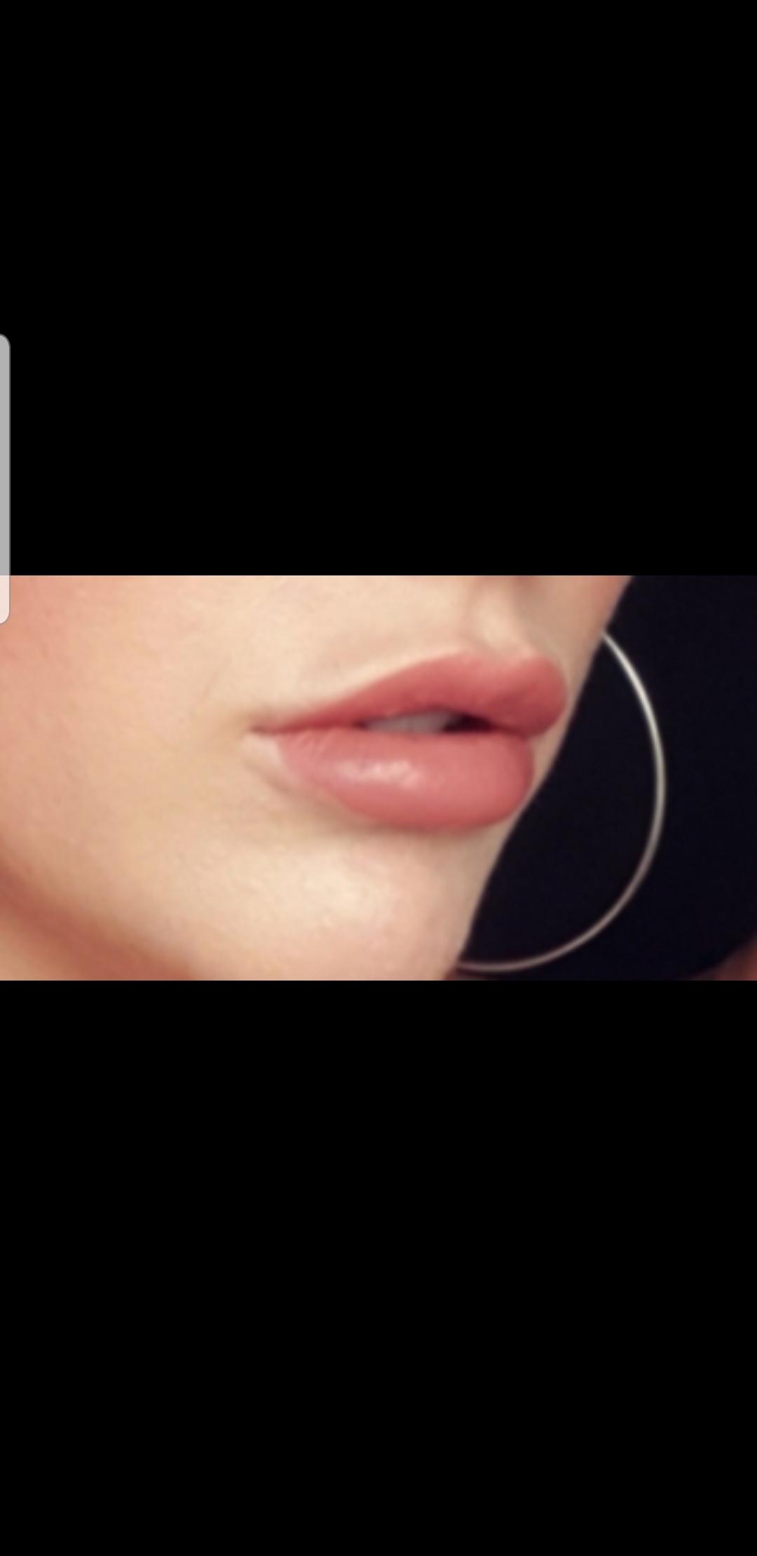 Leichte Schwellung An Den Lippen Sehr Auffallig Frauen Korper Beauty
