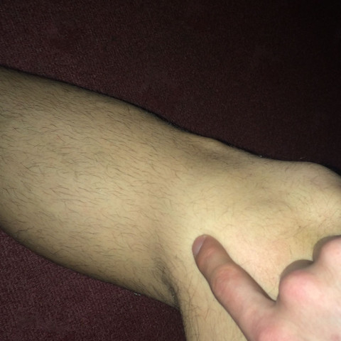 Rechtes Knie - (Fußball, Knie)