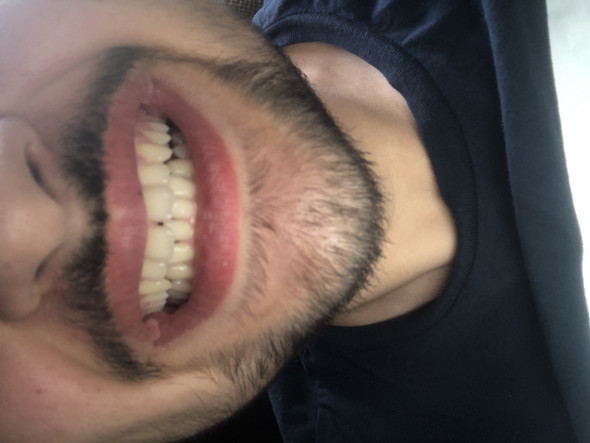 Zähne hässliche 