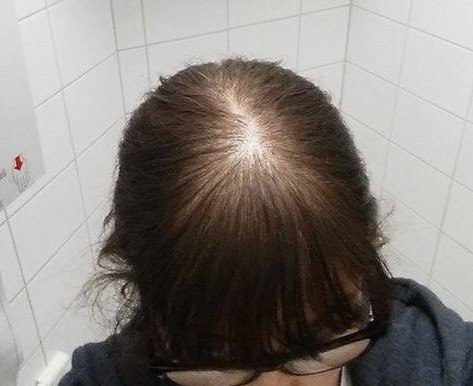 Mein lichtes Haar - (Haare, färben, Haarpflege)