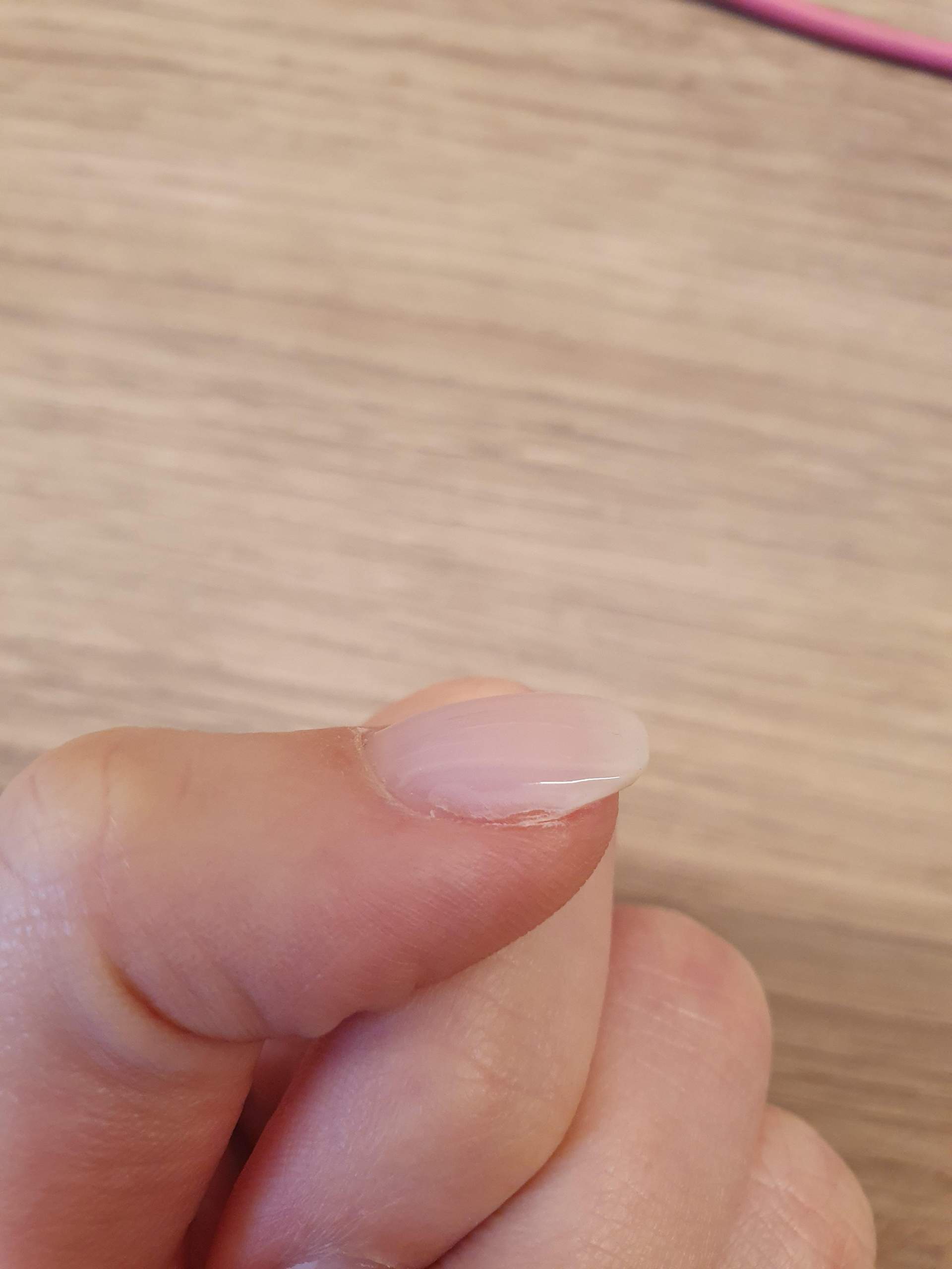 Liftings bei Gelnägeln/Naturnagelverstärkung (4 Tage alt) normal? (Fingernägel, Gelnägel