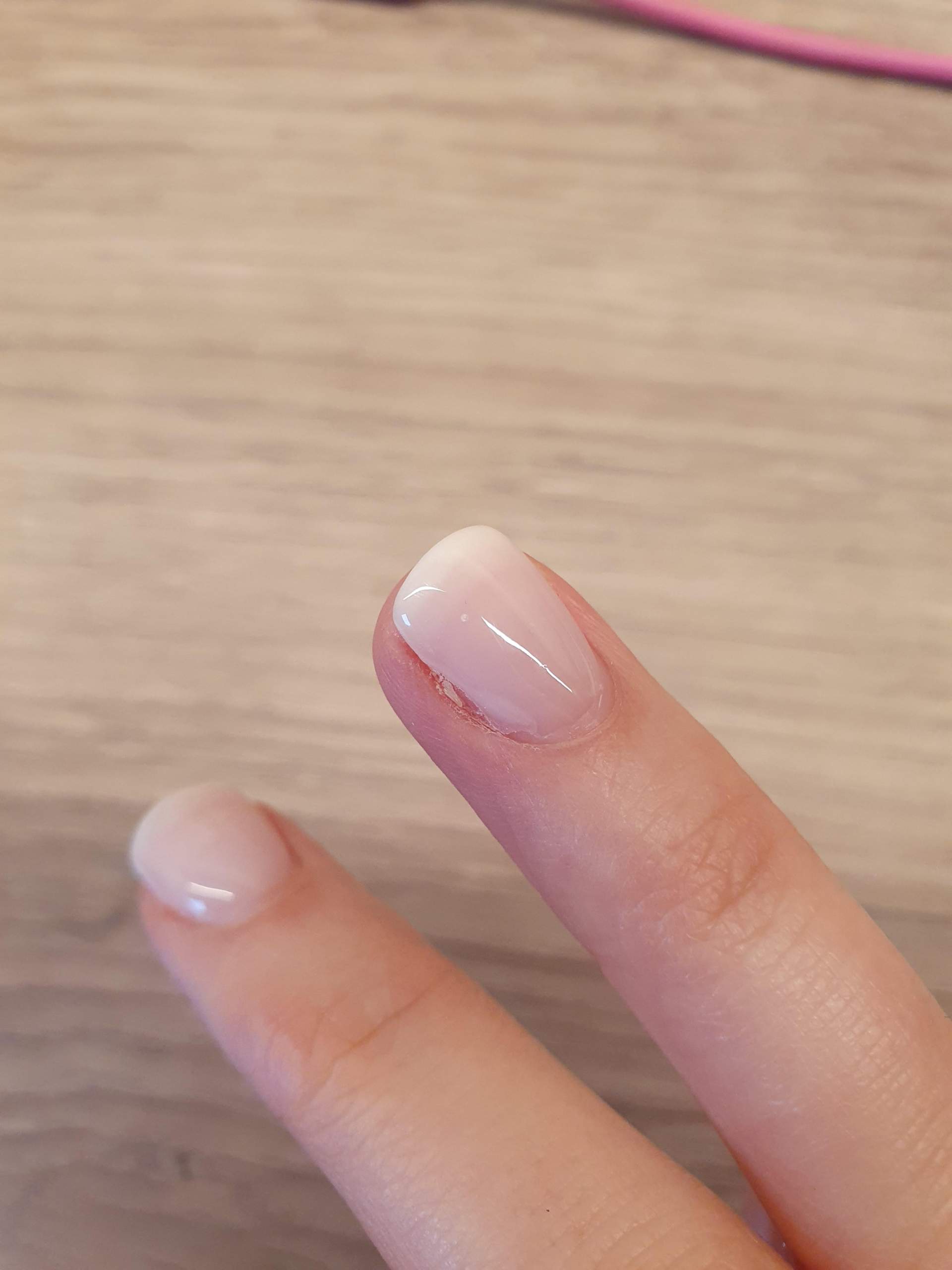 Liftings bei Gelnägeln/Naturnagelverstärkung (4 Tage alt) normal? (Fingernägel, Gelnägel