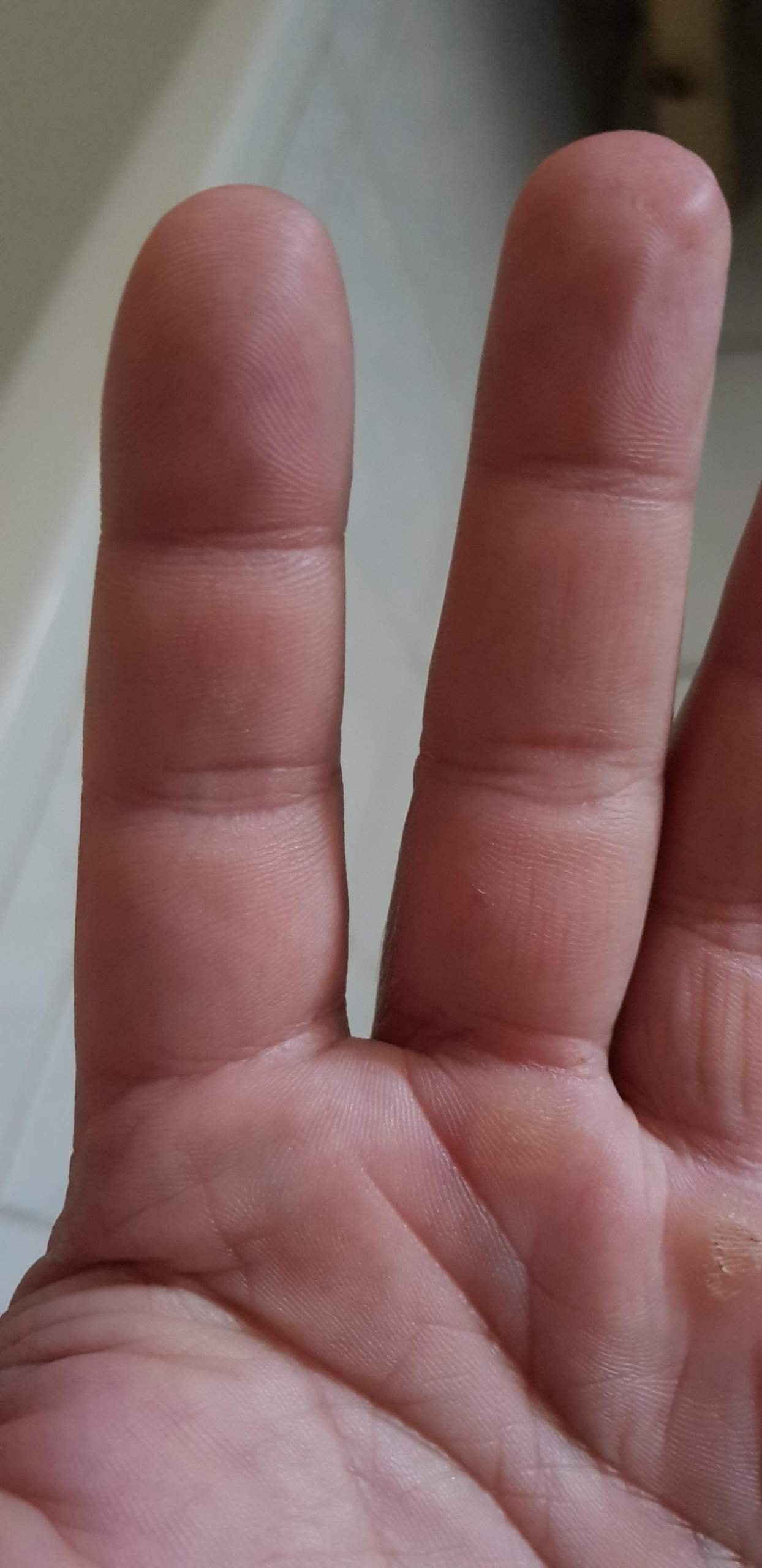 Linker Zeigefinger plötzlich taub? (Gesundheit und Medizin, Finger