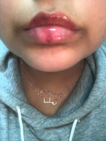 Lippen Brennen Und Sind Rot Beauty Lippenpflege