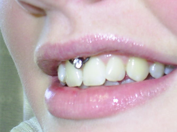 lippenbandchen piercing hufeisen ring oder freie auswahl