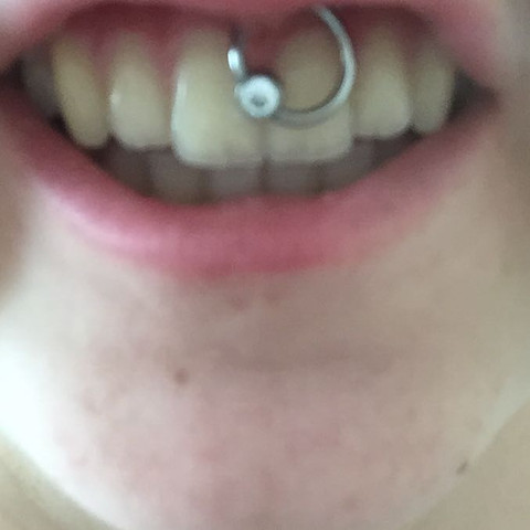 das ist mein Piercing - (Piercing, lippenbändchenpiercing)