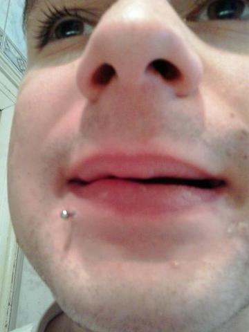 Lippenpiercing Mein Lippenpiercing An Der Lippe Hangt Etwas Durch Konnt Ihr Da Helfen Piercing