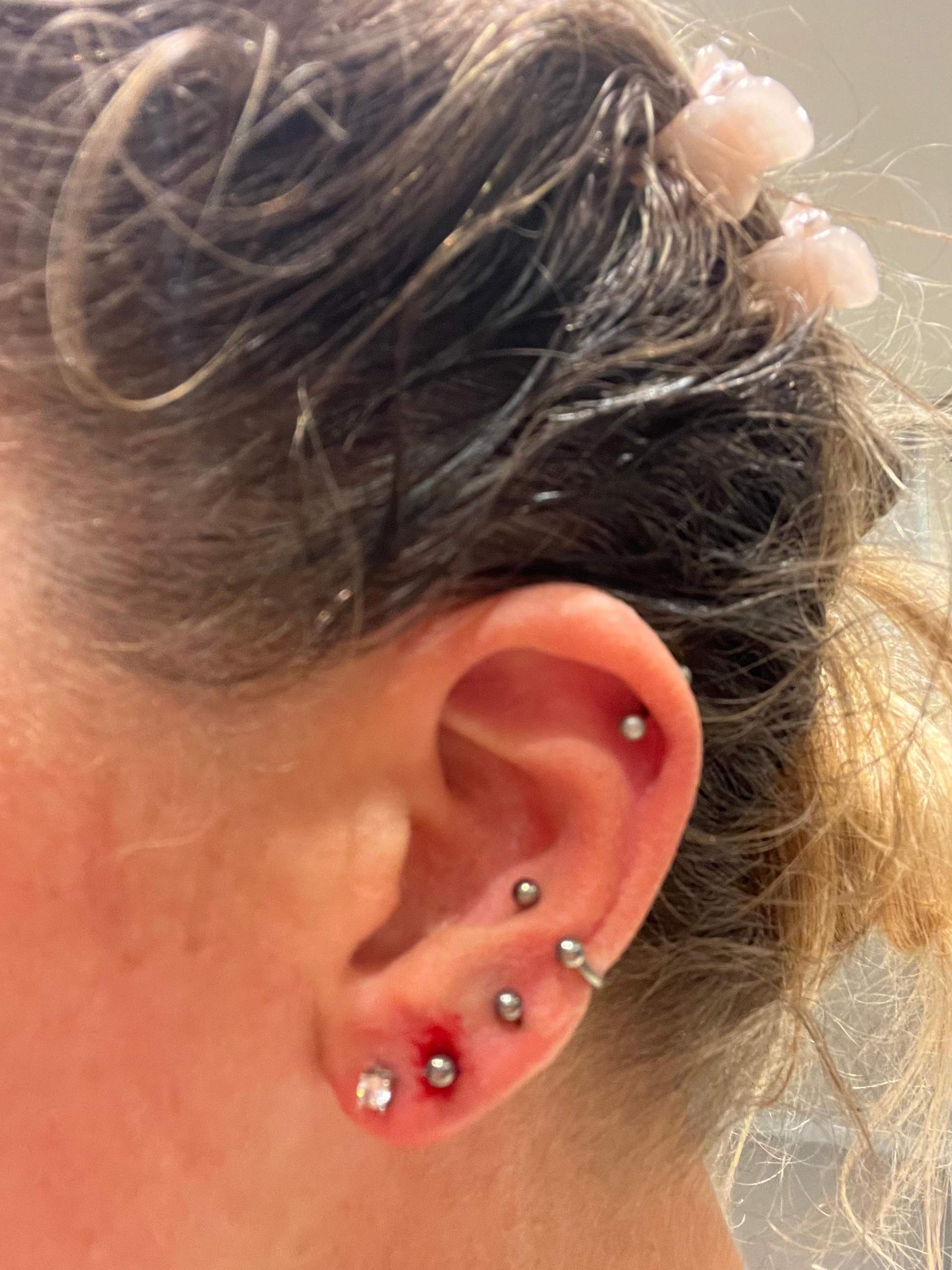 Lobe piercing hört nicht auf zu bluten. Normal? (Ohr, Ohrringe, Piercer)