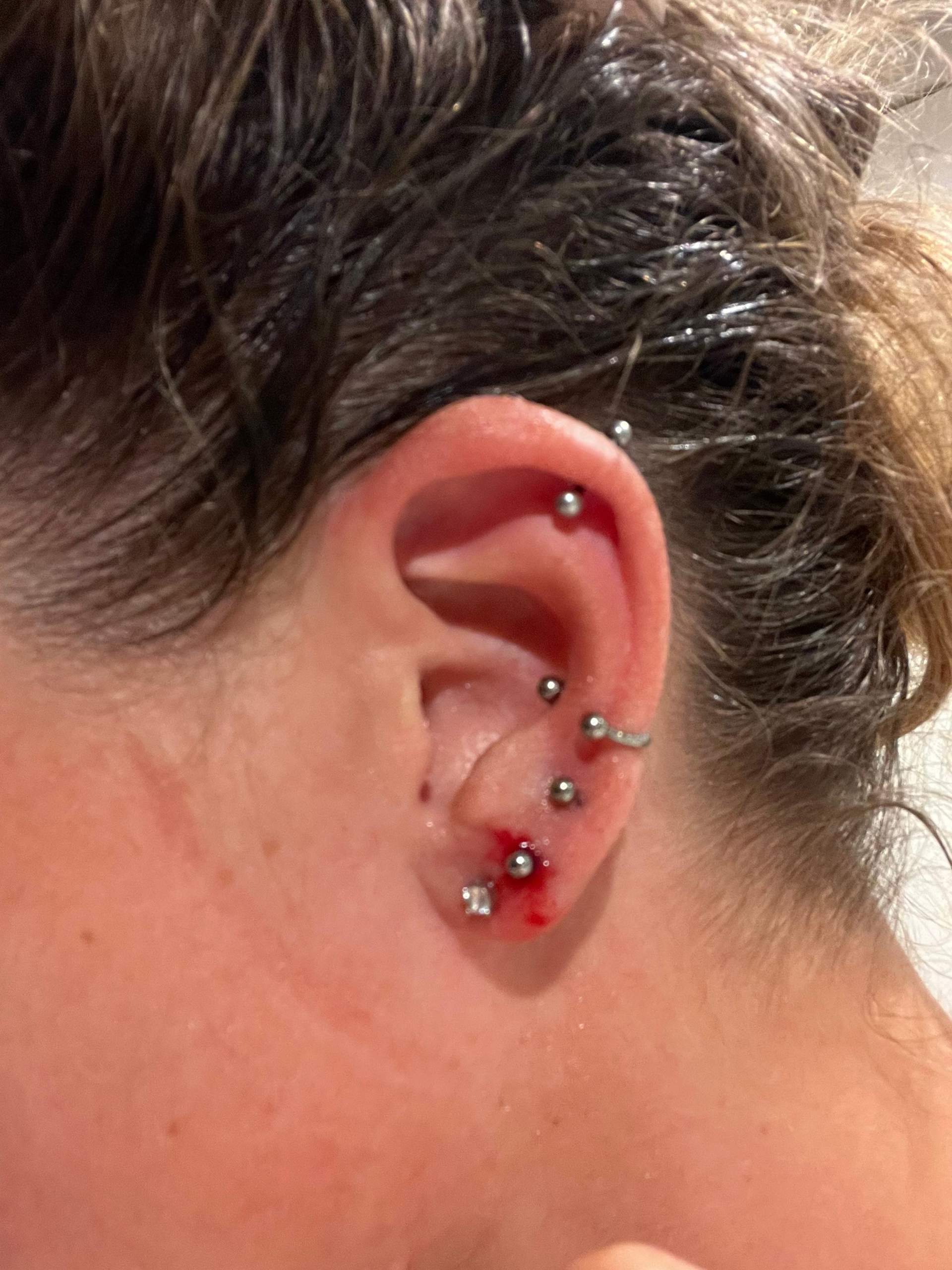 Lobe piercing hört nicht auf zu bluten. Normal? (Ohr, Ohrringe, Piercer)