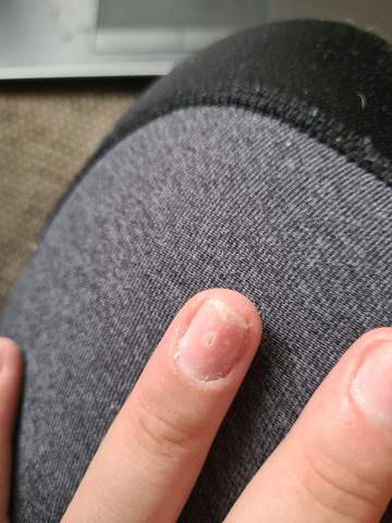 loch im fingernagel nagel nagelpflege