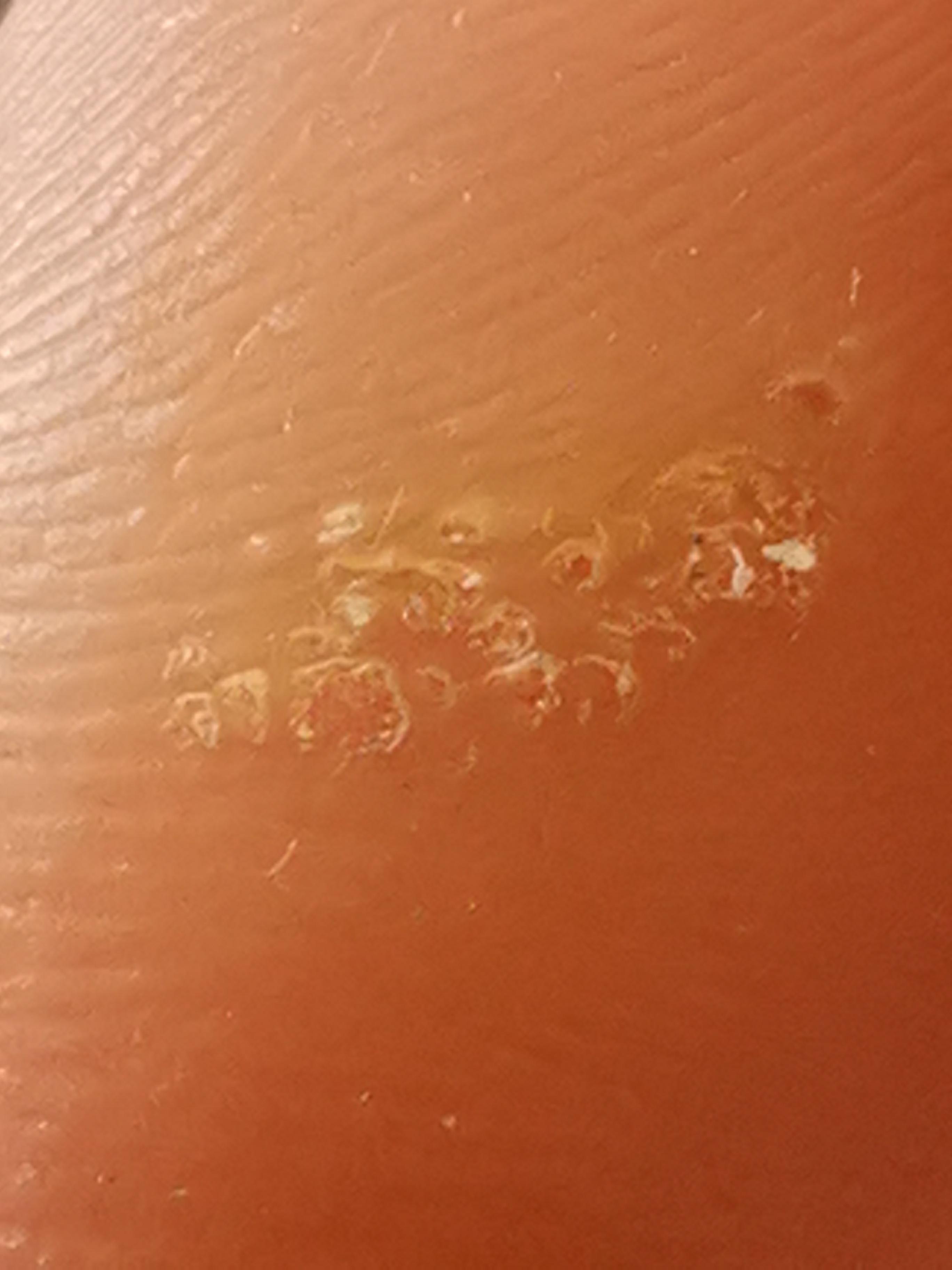 Locher In Hornhaut Kann Jmd Mir Sagen Was Das Ist Fusse Locher In Hornhaut Kann Jmd Mir Sagen Was Das Ist Fusse