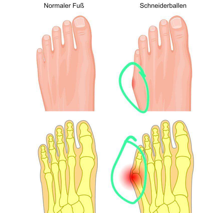 Louboutins bei breiten Füßen? (Schuhe, High Heels, Bequemlichkeit)