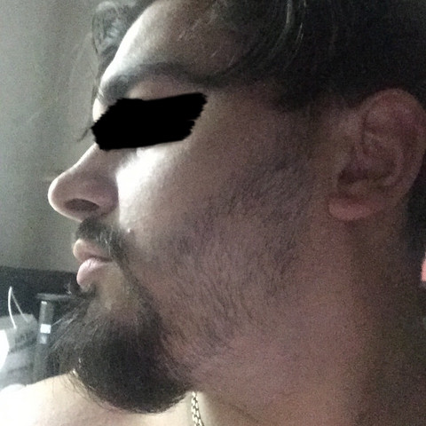 Lucken Hafter Bart Trotzdem Wachsen Lassen Bartwuchs Bartwachstum