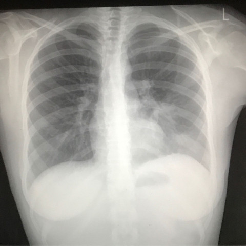 Röntgenbild Oktober - (Gesundheit und Medizin, Röntgen, Karzinom)