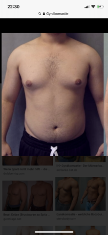 Manner Brust Gynakomastie Wie Beheben Wegbekommen Bild Krankheit Sport Und Fitness Training