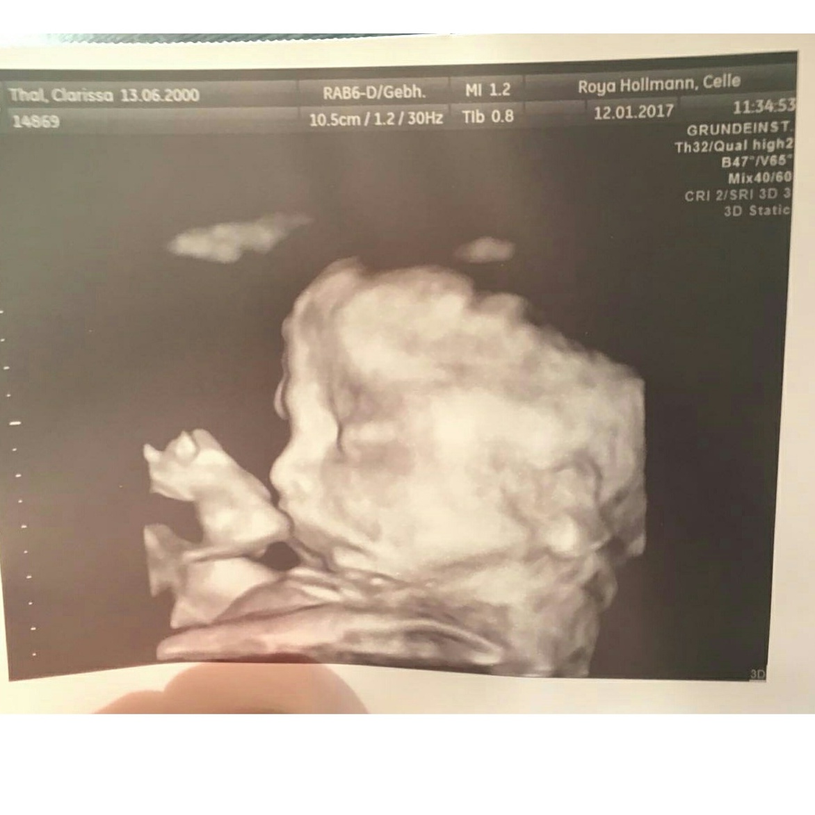 Magnesium Kautabletten In Der 25 Ssw Baby Magnesium Kautabletten In Der 25 Ssw Baby