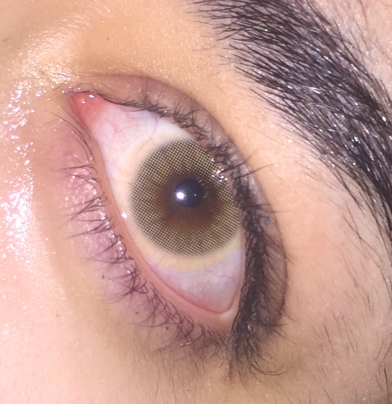 Man Sieht Den Rand Meiner Kontaktlinsen Grosse Farblinsen