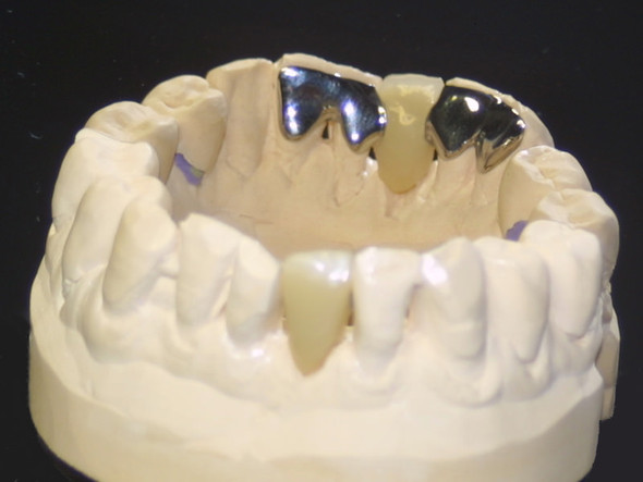 So sieht es von innen aus  - (Zähne, Zahnarzt, Kieferorthopäde)