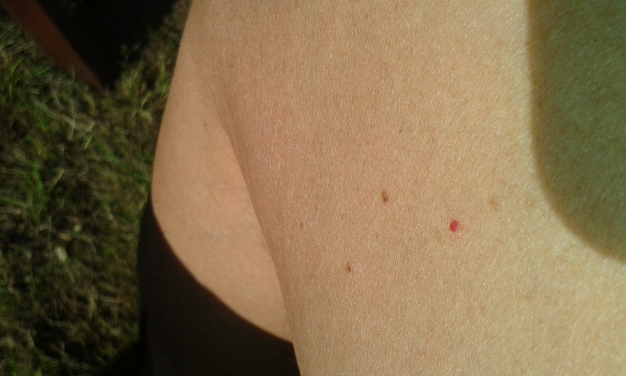 Medizin Rat suchend, Roter Punkt auf der Haut