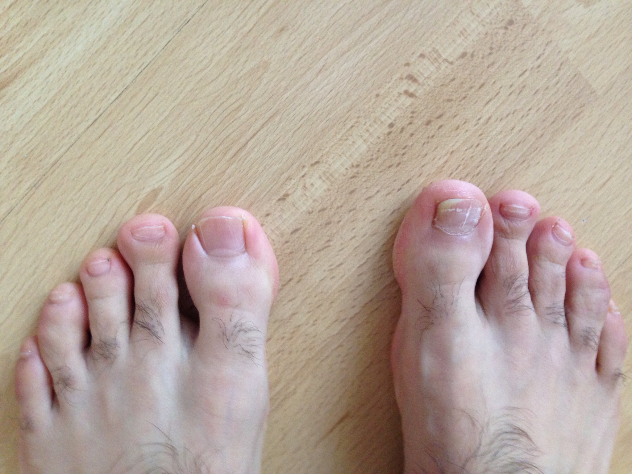 Medizinische Frage Fuss (Krankheit)