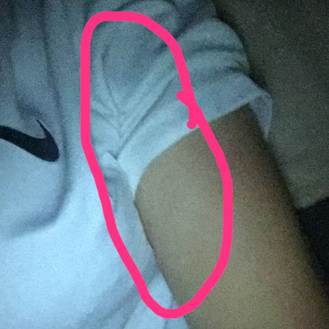 Mega Schmerzen Im Rechten Oberarm Gesundheit Und Medizin Sport Und Fitness Arzt Mega Schmerzen Im Rechten Oberarm Gesundheit Und Medizin Sport Und Fitness Arzt