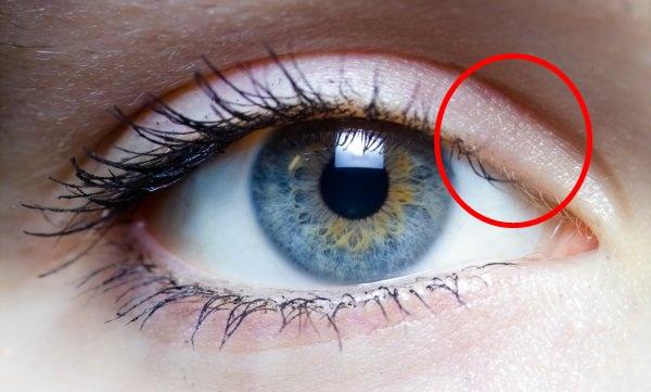 mein auge tut weh warum was ist das.? (Arzt, Schmerzen, Augen)