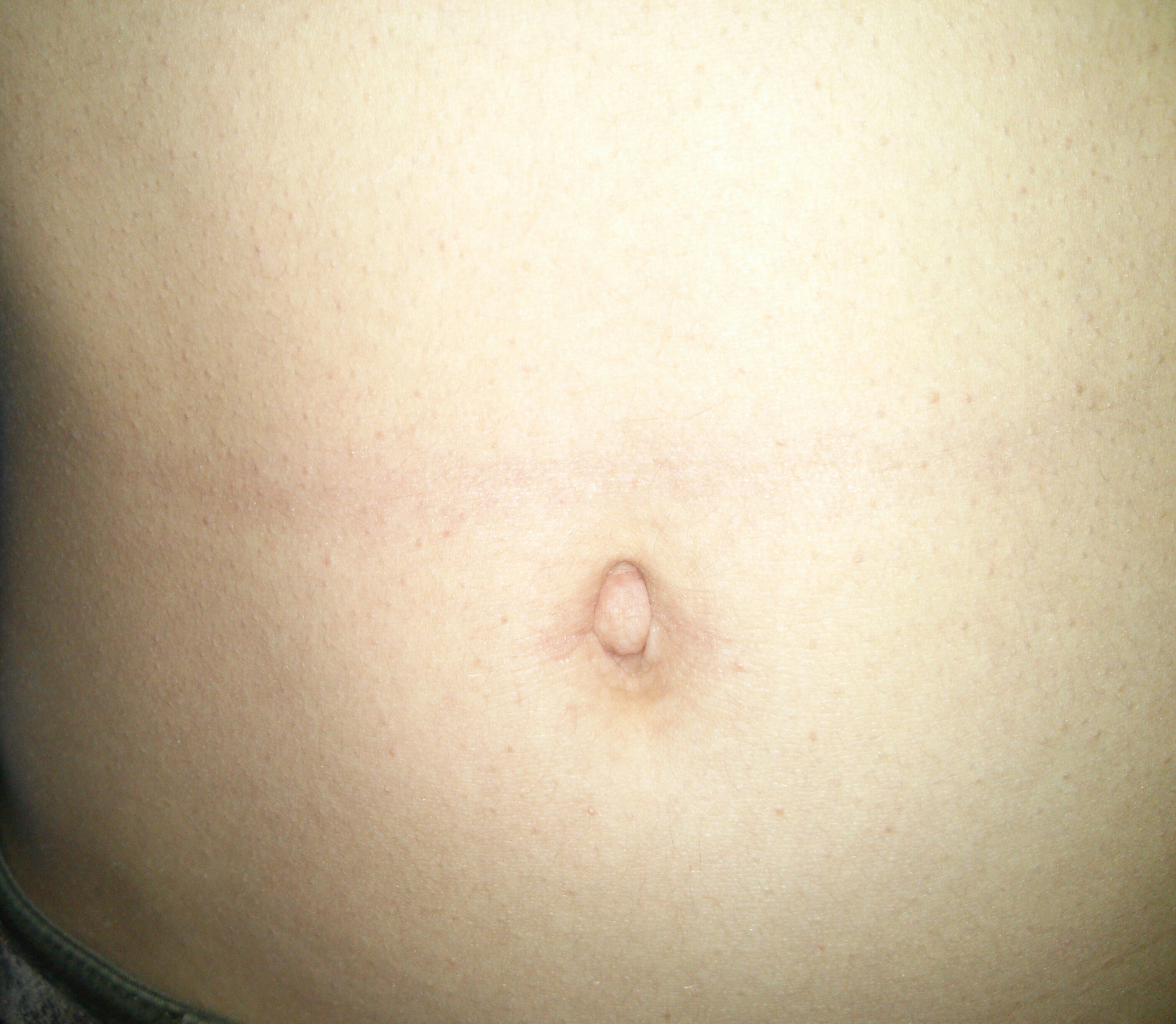 haben hunde einen bauchnabel