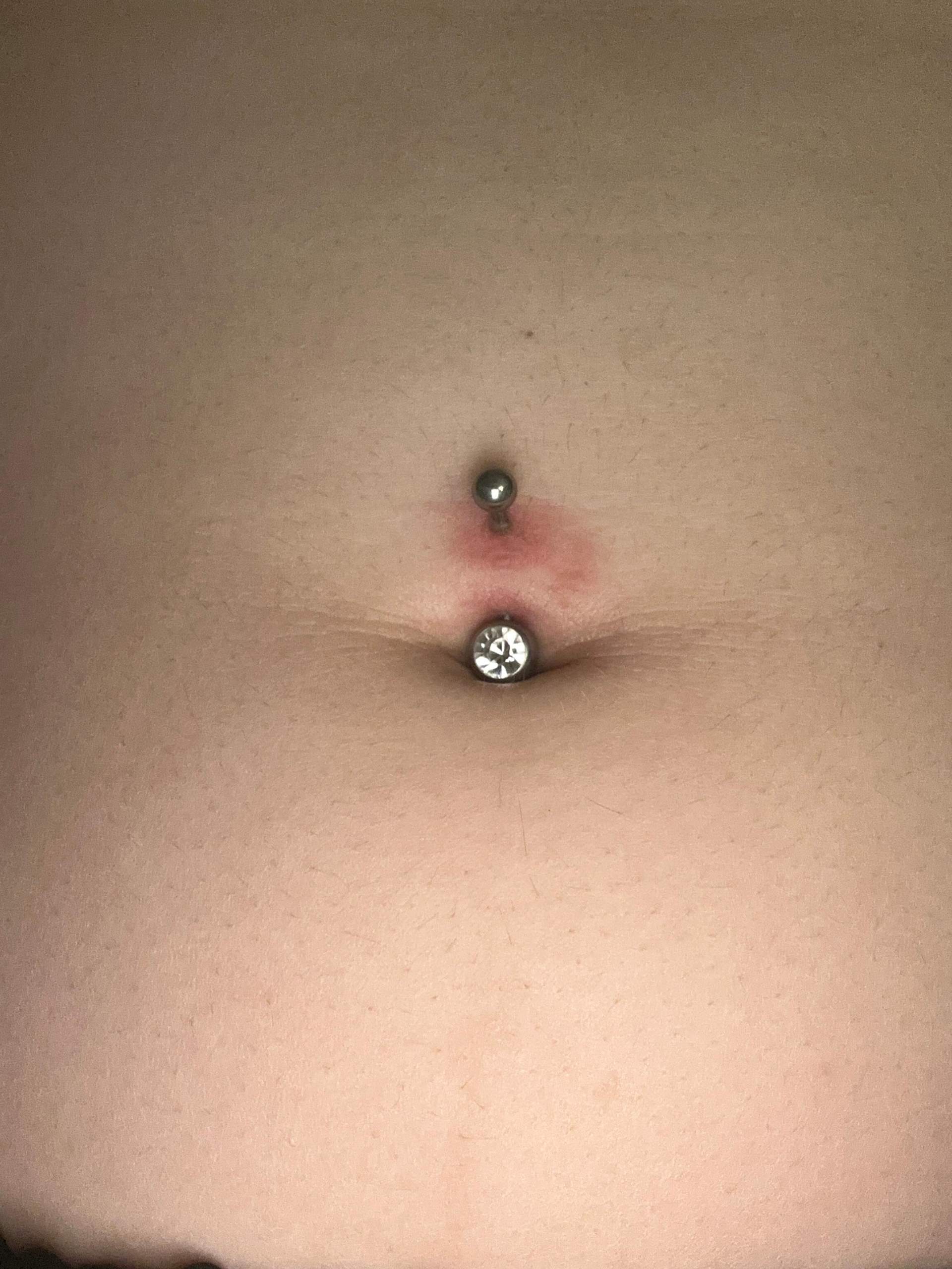 Mein bauchnabelpiercing ist jetzt paar tage alt und ich weiss nicht ob ...