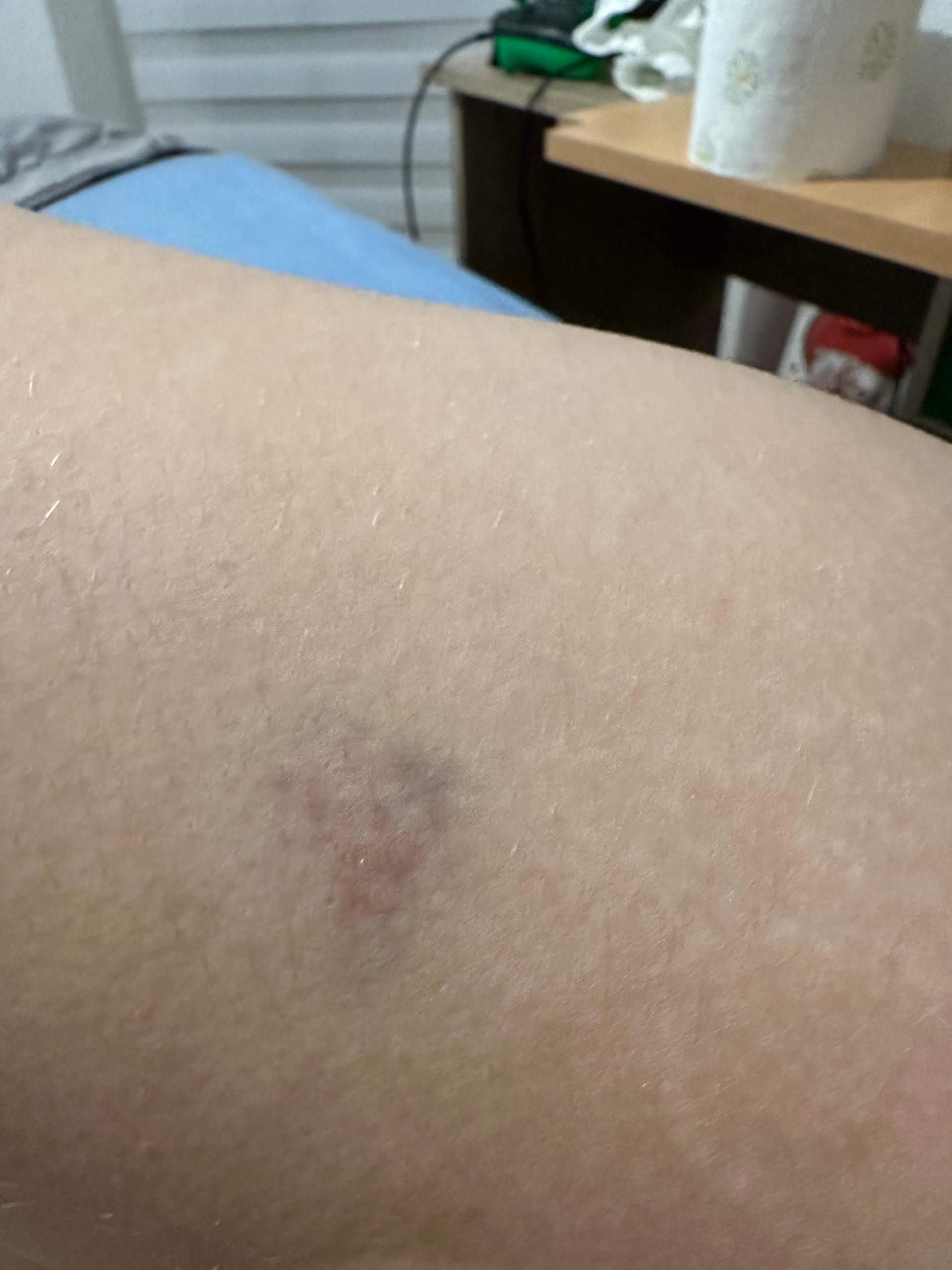 Meine Freundin Wird Geschlagen Was Kann Ich Tun