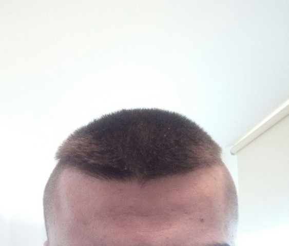 Mein Friseur Epic Fail Schaut Euchs An