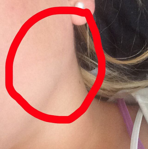 Mein Kiefer Tut Weh Was Tun Mund Verletzt Mein Kiefer Tut Weh Was Tun Mund Verletzt