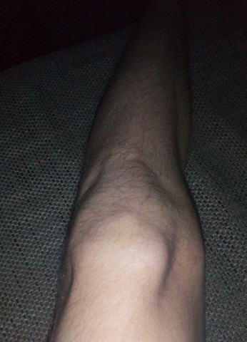- (Körper, Aussehen, Knie)