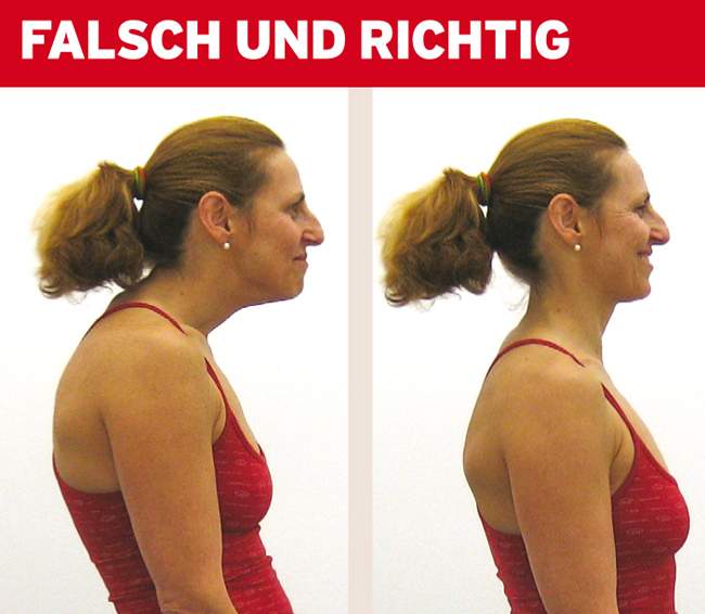 Mein Kopf steht zu weit nach vorne? (Sport)