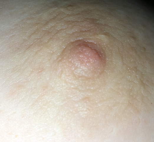 Mein Linker Nippel Gesundheit Und Medizin Brust Jucken Mein Linker Nippel Gesundheit Und Medizin Brust Jucken