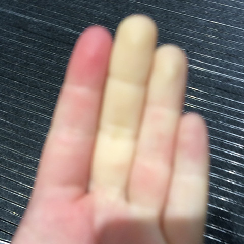 Das ist der gelbe Finger - (Gesundheit, Haut)