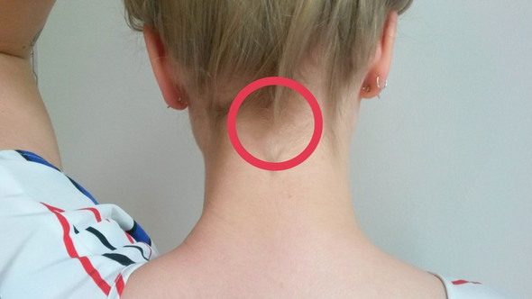 Mein Nacken Knackt Oder Was Ist Das Kopf Knochen Knacken Mein Nacken Knackt Oder Was Ist Das Kopf Knochen Knacken
