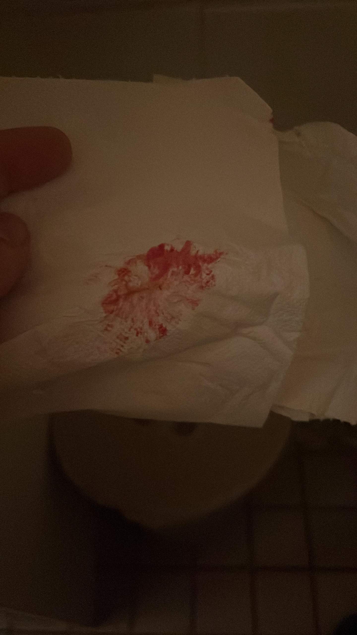 Mein Po blutet mein abwischen? (Gesundheit und Medizin, Blut, Anus) Mein Po blutet mein abwischen? (Gesundheit und Medizin, Blut, Anus)