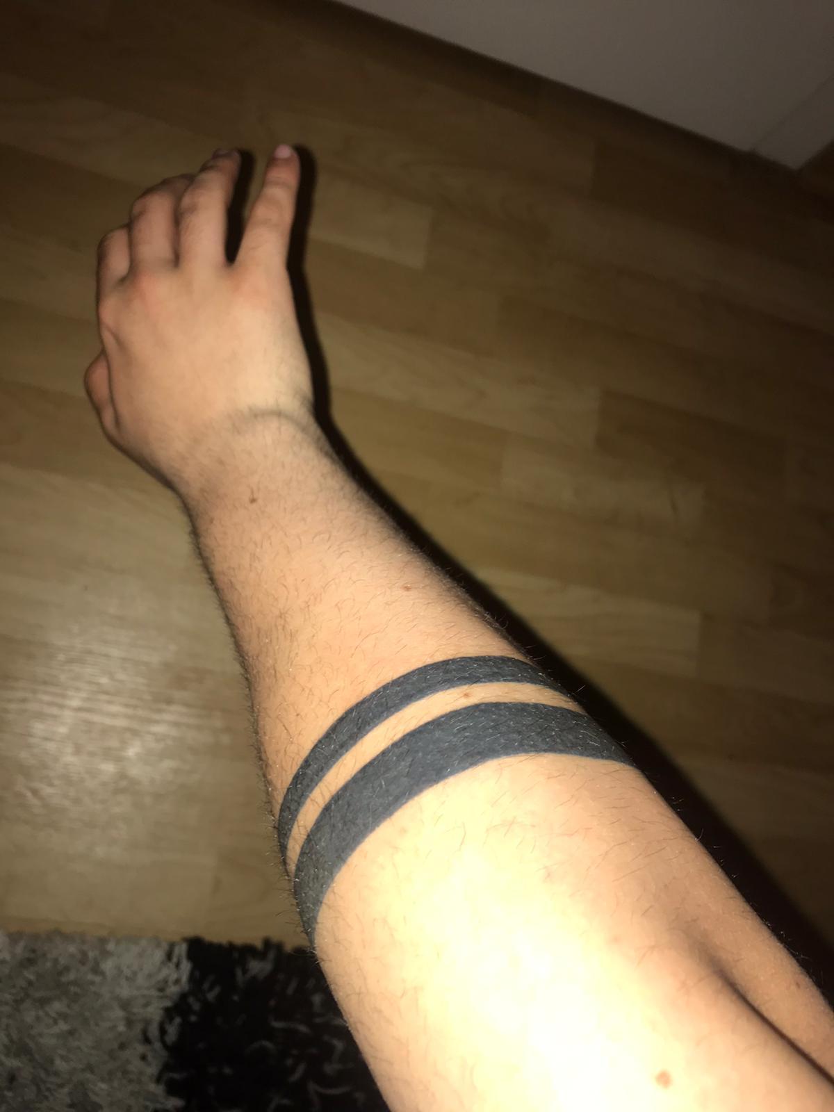 Mein Tattoo verheilt einfach nicht? (Gesundheit und Medizin, tätowieren