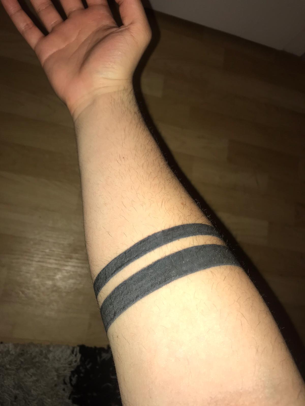 Mein Tattoo verheilt einfach nicht? (Gesundheit und Medizin, tätowieren