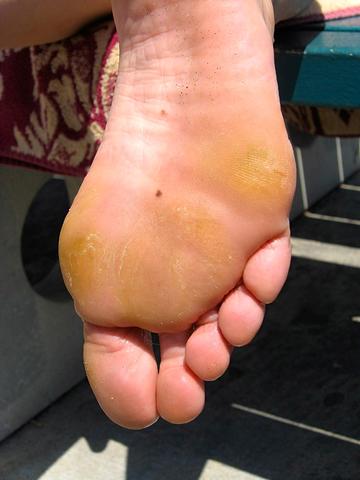 Die Haut, meiner Füße, ist immer ganz gelb! - (Gesundheit, Medizin, Körper)