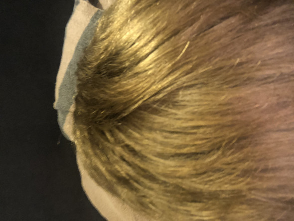 Meine Haare Sind Gold Bitte Dringend Um Hilfe Verzweiflung Farben Antwort Grun