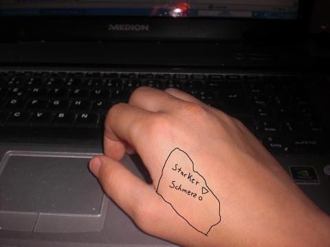 Meine Hand - (Arzt, Schmerzen)
