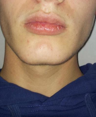 Meine Lippen... - (Medizin, Körper, Arzt)