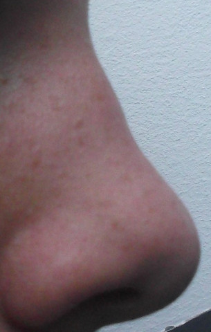 Meine Nase ist mega hässlichMeinungen? Bitte ehrlich Meine Nase ist mega hässlichMeinungen? Bitte ehrlich