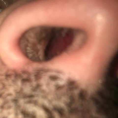 25+ großartig Vorrat Nase Innen Entzündet : Entzündung in der Nase - Ursachen, Behandlung & Hilfe ... / Eine trockene nase (rhinitis sicca) juckt und fühlt sich verstopft an. 25+ großartig Vorrat Nase Innen Entzündet : Entzündung in der Nase - Ursachen, Behandlung & Hilfe ... / Eine trockene nase (rhinitis sicca) juckt und fühlt sich verstopft an.