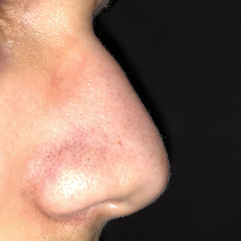 Meine Nase Ist Ziemlich Gross Und Hat Einen Buckel Beauty Aussehen Schonheit Meine Nase Ist Ziemlich Gross Und Hat Einen Buckel Beauty Aussehen Schonheit