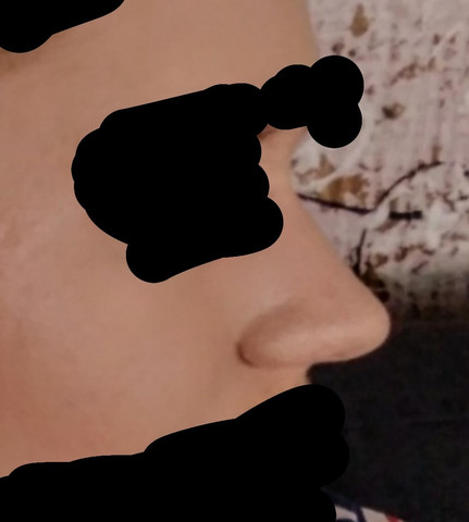 Nase zu groß frau