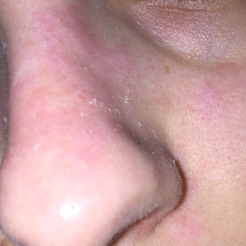 Meine Nase Schalt Sich Was Soll Ich Tun Hilfe Haut Gesicht Schminke Meine Nase Schalt Sich Was Soll Ich Tun Hilfe Haut Gesicht Schminke